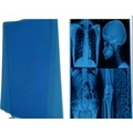 FILM X RAY 43.18 CM X 35.56 CM (17 X 14)